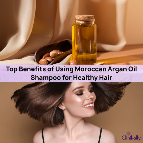 Top Benefits of Using Moroccan Argan Oil Shampoo for Healthy Hair
