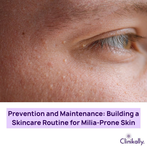 Prevention and Maintenance: Building a Skincare Routine for Milia-Prone Skin