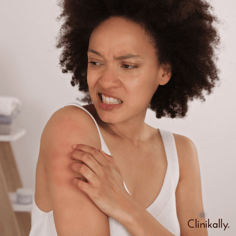 Propanediol for Reducing Irritation