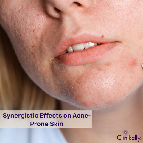 Synergistic Effects on Acne-Prone Skin
