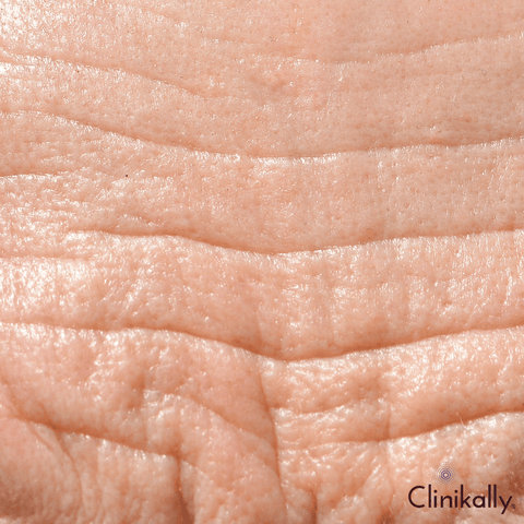 Myth: Wrinkles are the only sign of aging