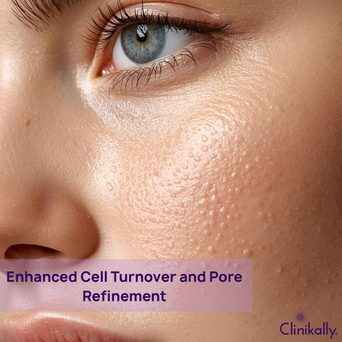 Enhanced Cell Turnover and Pore Refinement