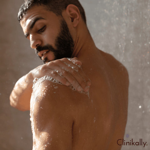 Acne body washes and soaps