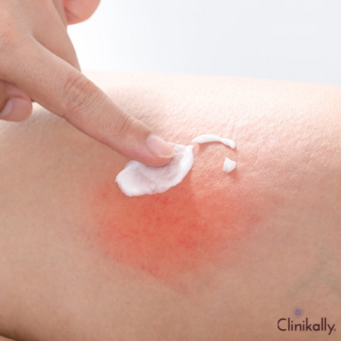 metronidazole uses 