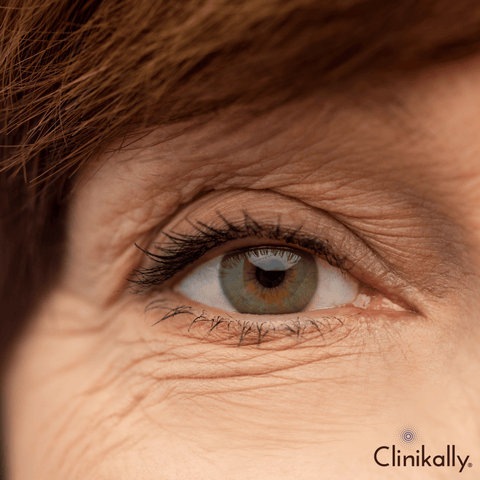 How the Skin Aging Process Affects Elastin