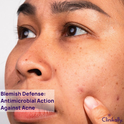 Blemish Defense: Antimicrobial Action Against Acne