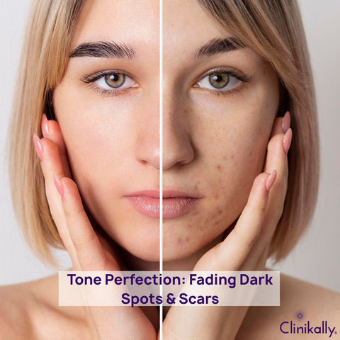 Tone Perfection: Fading Dark Spots & Scars