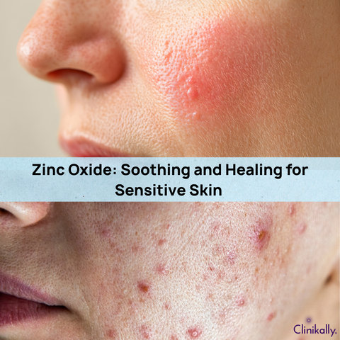 Zinc Oxide: Soothing and Healing for Sensitive Skin