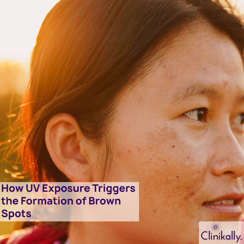 How UV Exposure Triggers the Formation of Brown Spots