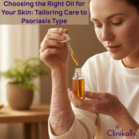 Choosing the Right Oil for Your Skin: Tailoring Care to Psoriasis Type