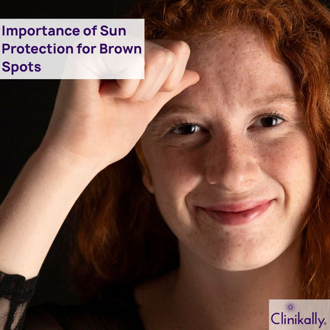The Importance of Sun Protection for Brown Spots