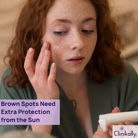 Why Brown Spots Need Extra Protection from the Sun