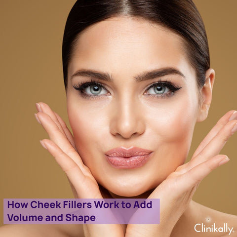 How Cheek Fillers Work to Add Volume and Shape