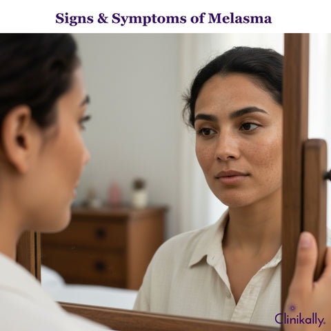 Melasma Symptoms: Recognising the Signs of Skin Discolouration