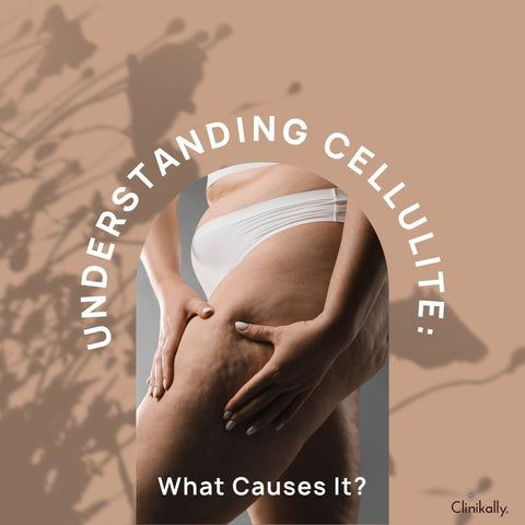 Understanding Cellulite: What Causes It?