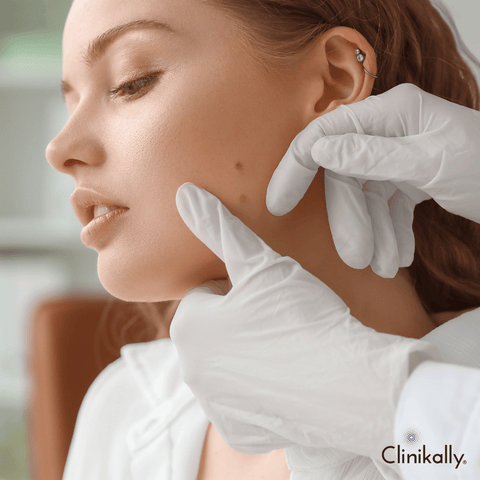 Fade dark spots with personalised treatment
