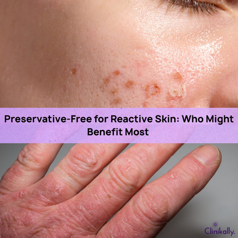 Preservative-Free for Reactive Skin: Who Might Benefit Most