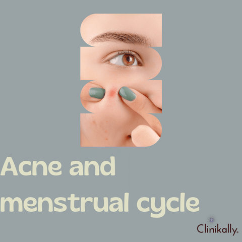 Acne and menstrual cycle