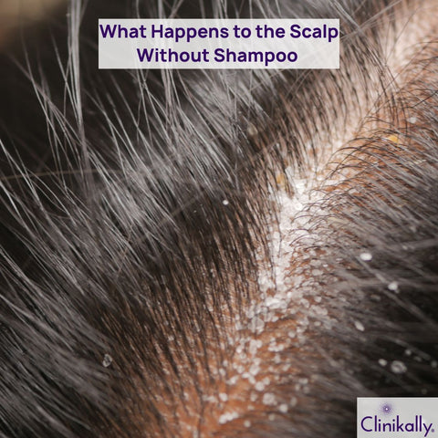 What Happens to the Scalp Without Shampoo