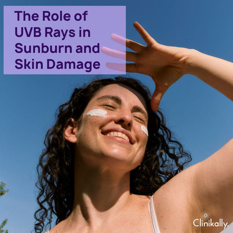 The Role of UVB Rays in Sunburn and Skin Damage