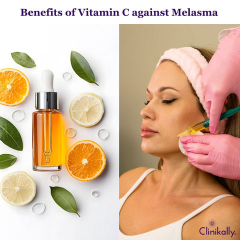 Melasma and Vitamin C: Understanding the Benefits for Skin Discolouration