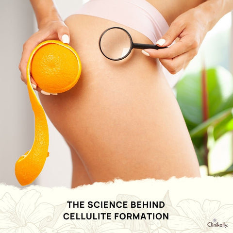 The Science Behind Cellulite Formation