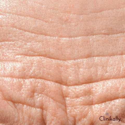 Reduces fine lines and wrinkles