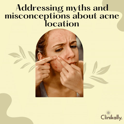 Addressing myths and misconceptions about acne location