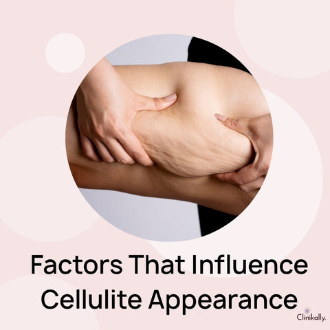 Factors That Influence Cellulite Appearance