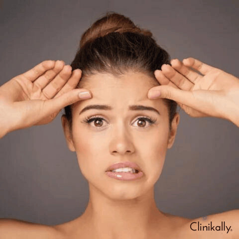 What causes combination skin