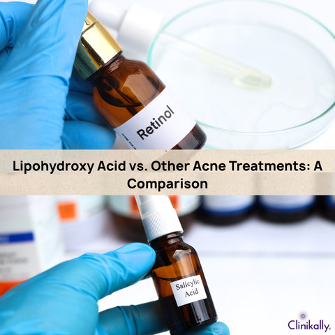 Lipohydroxy Acid vs. Other Acne Treatments: A Comparison