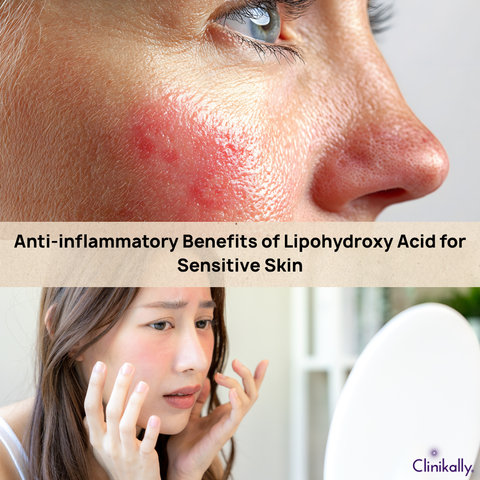 Anti-inflammatory Benefits of Lipohydroxy Acid for Sensitive Skin