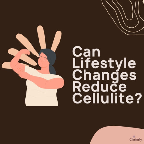 Can Lifestyle Changes Reduce Cellulite?