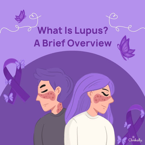 What Is Lupus? A Brief Overview