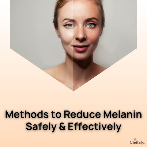 Methods to Reduce Melanin Safely & Effectively
