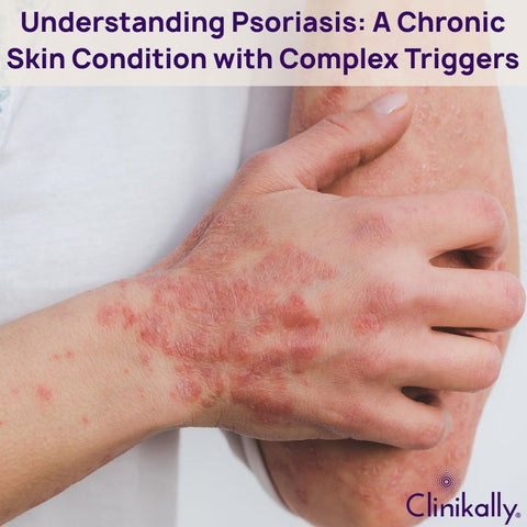 What is Psoriasis