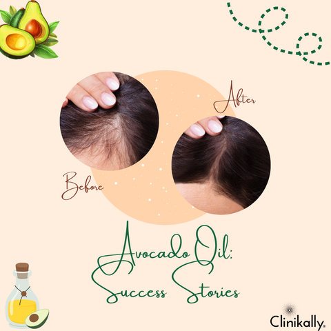 Real Stories: Avocado Oil Success Stories