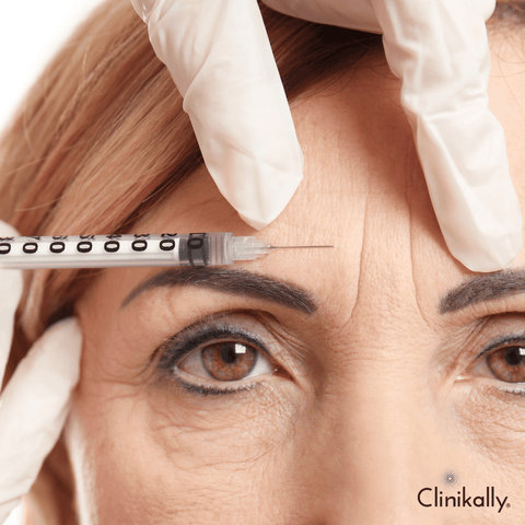 Modern dermatological advancements in wrinkle reduction