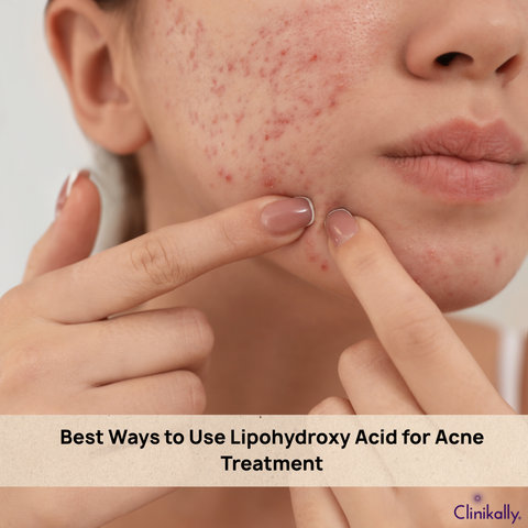  Best Ways to Use Lipohydroxy Acid for Acne Treatment