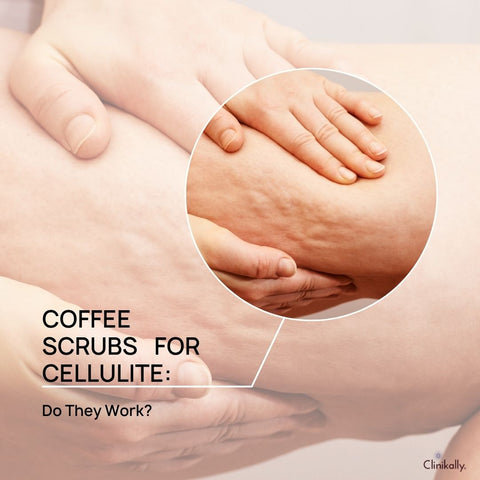 Coffee Scrubs for Cellulite: Do They Work?