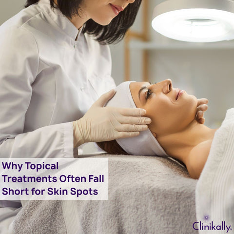 Why Topical Treatments Often Fall Short for Skin Spots