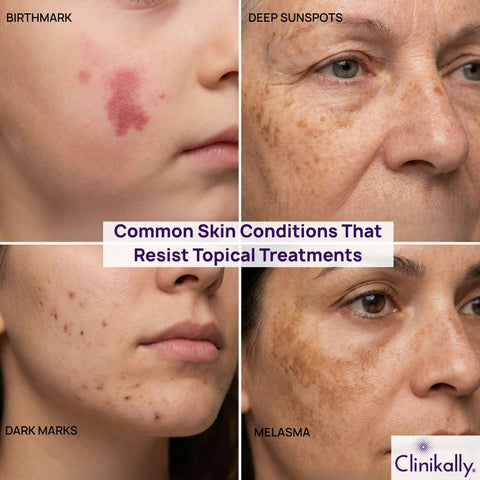 Common Skin Conditions That Resist Topical Treatments