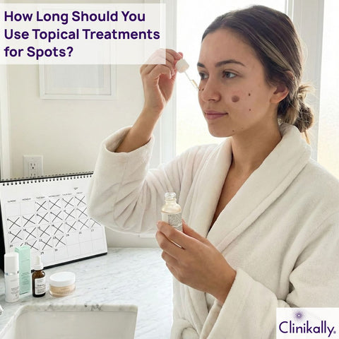 How Long Should You Use Topical Treatments for Spots?