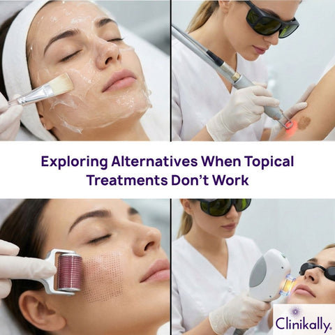 Exploring Alternatives When Topical Treatments Don’t Work