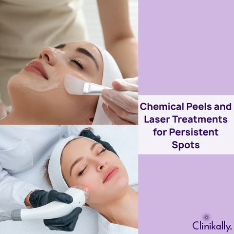 Chemical Peels and Laser Treatments for Persistent Spots