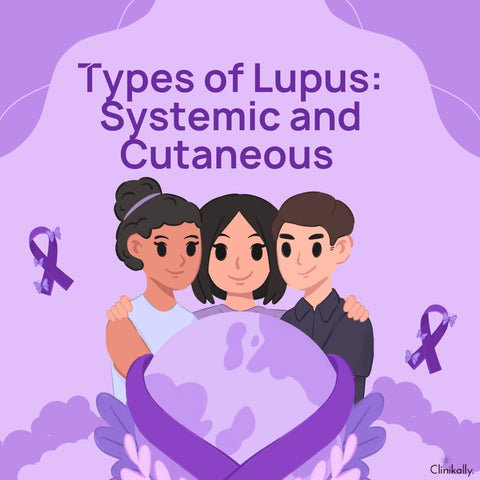 Types of Lupus: Systemic and Cutaneous