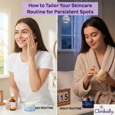How to Tailor Your Skincare Routine for Persistent Spots