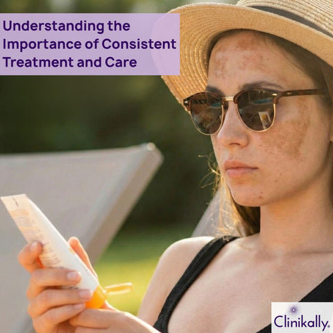 Understanding the Importance of Consistent Treatment and Care