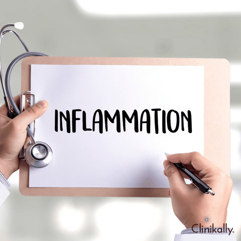 Anti-Inflammatory Properties of Azelaic Acid for Rosacea