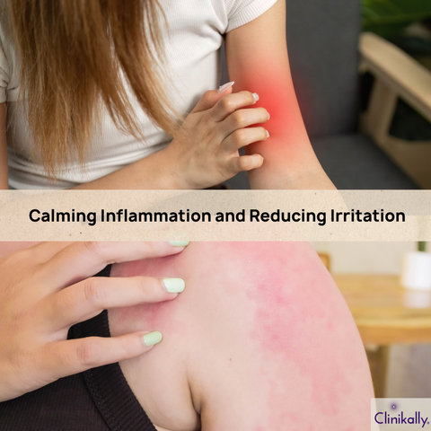 Calming Inflammation and Reducing Irritation